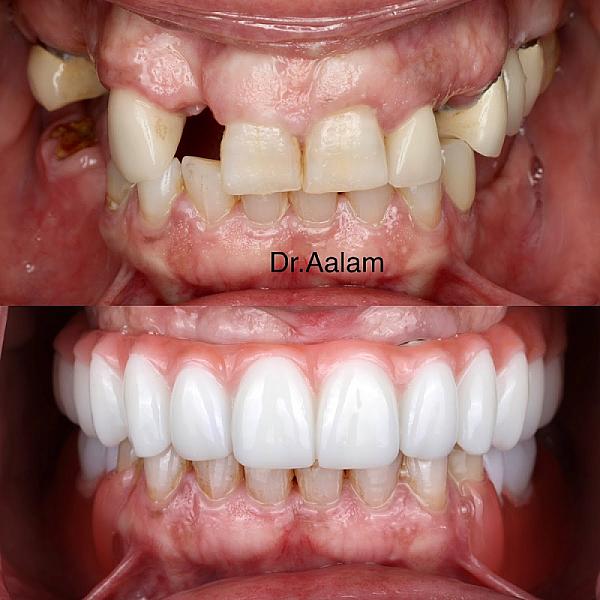 Center for Advanced Periodontal & Implant Therapy